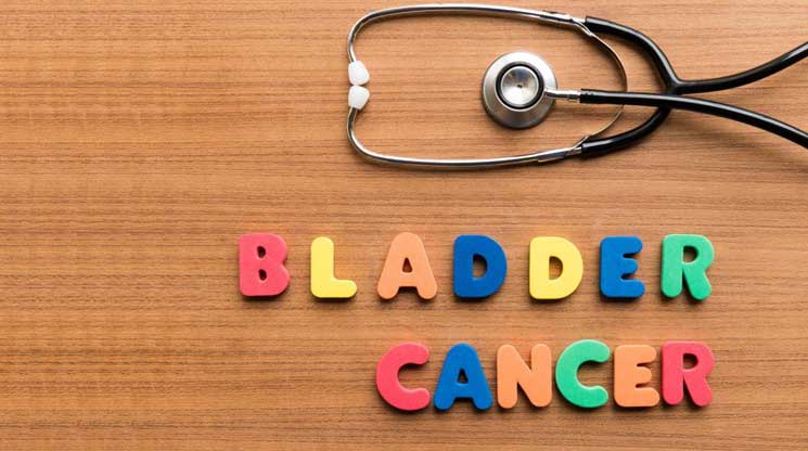 The Common Causes of Bladder Cancer You Should Know About
